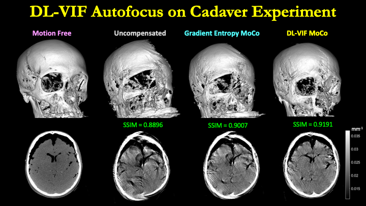 Rigid Motion Compensation on Cadaver Head